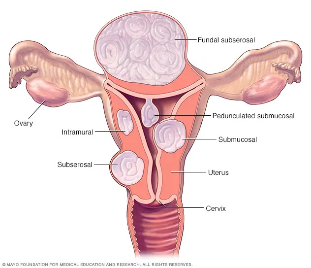 uterus