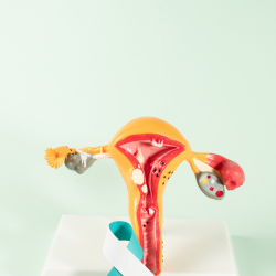 Cervical Cancer (1) Cervical Cancer 1