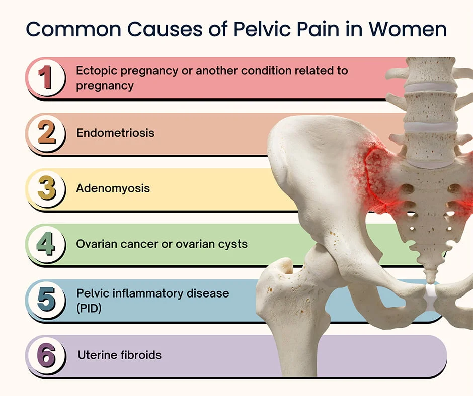 Chronic Pelvic Pain- Laparoscopy