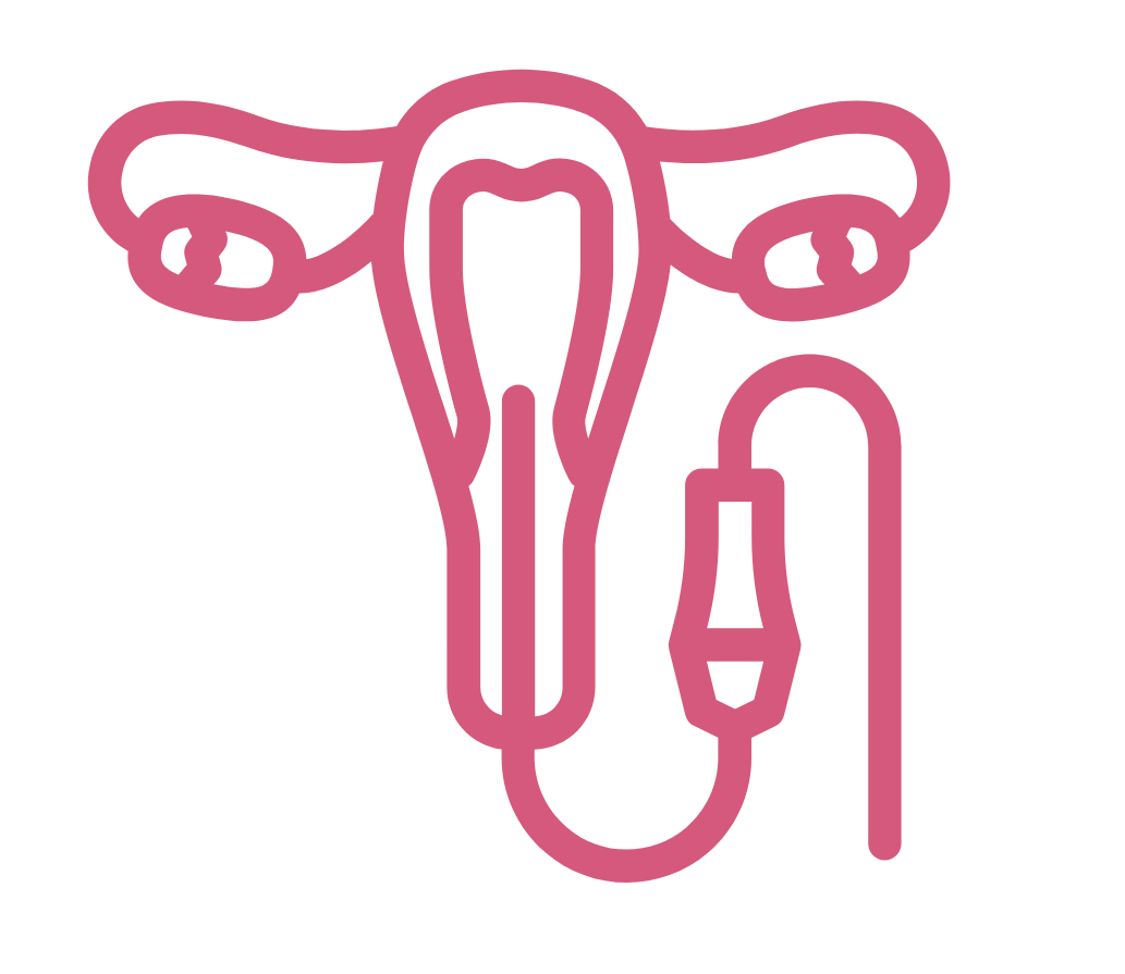 Hysteroscopy Hysteroscopy