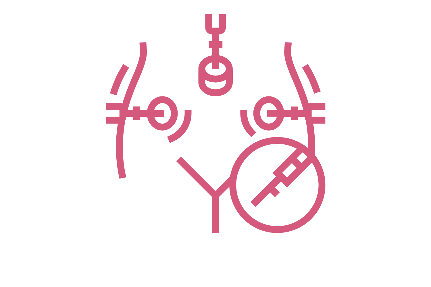 Laparoscopic Vaginoplasty Laparoscopic Vaginoplasty