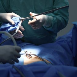 Laparoscopy Laparoscopy