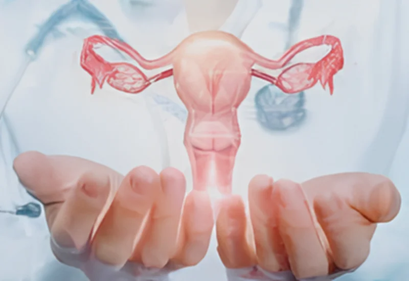 Prevention- Ovarian cancer