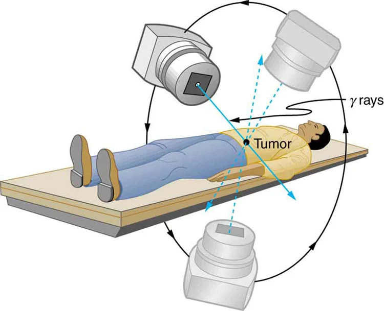 Radiation Therapy- Vaginal Cancer
