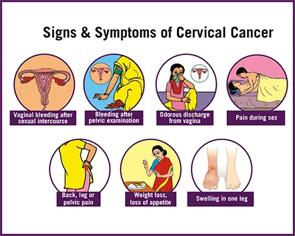 Signs & Symptoms of Cervical Cancer Cervical Cancer