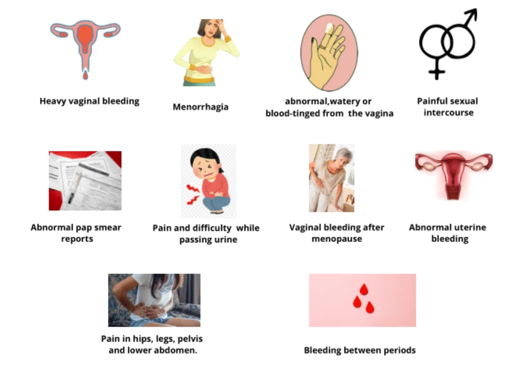 Symptoms of Uterine Cancer Uterine Cancer