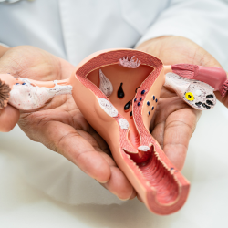 Uterine Cancer (1) Uterine Cancer 1
