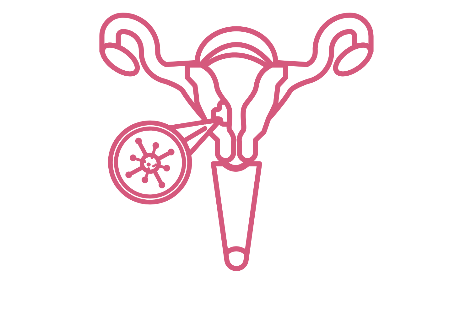 Uterine Cancer Uterine Cancer
