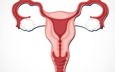 Are Fibroids Affecting Your Fertility and Daily Life 