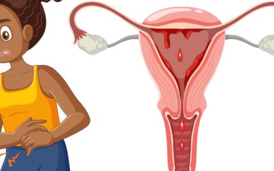 Period Pain or Fibroids? Know the Early Warning Signs 