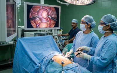 Laparoscopic Myomectomy: When Is It Recommended for Fibroids? 